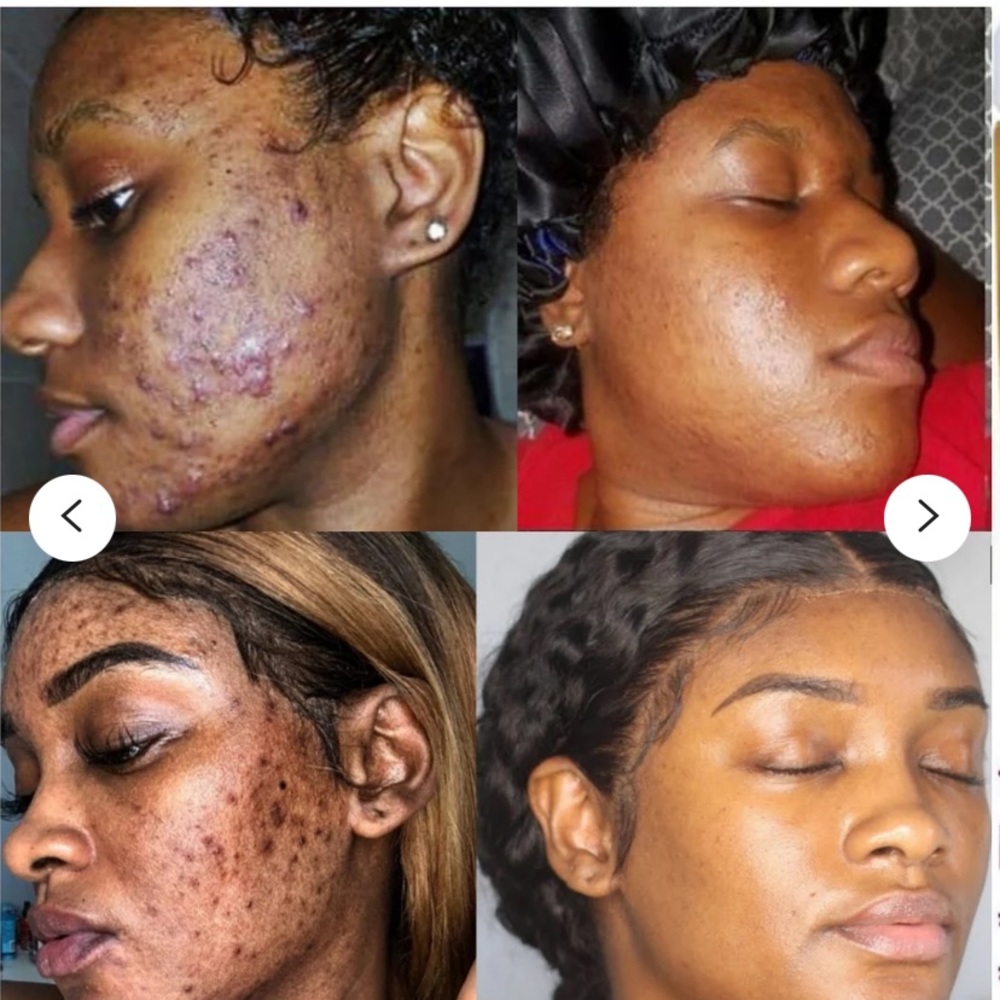 Turmeric Mud Clay Mask